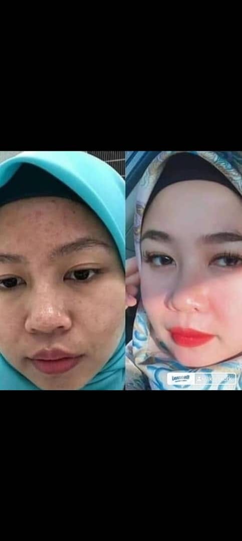 Testimoni